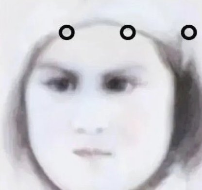 有些人确实形成黑圈了。