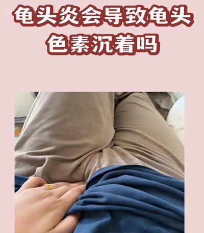 有些人确实形成黑圈了。